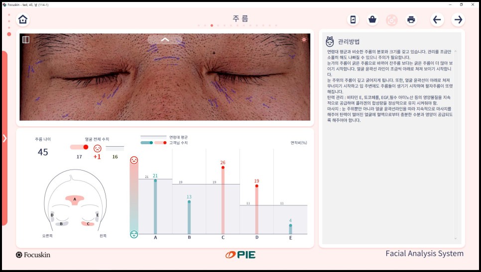 FOCUSKIN7 test_Wrinkles_주름.jpg