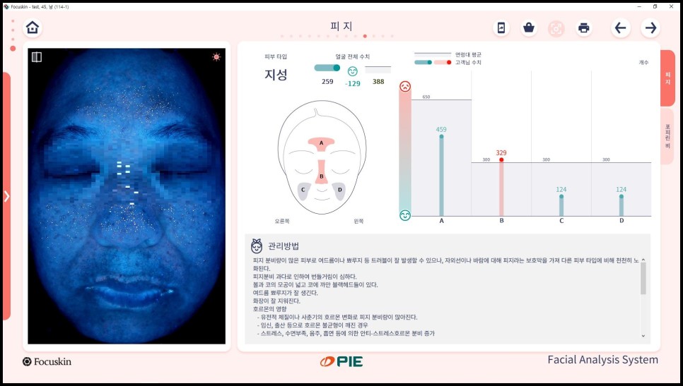 FOCUSKIN13 test_Sebum_피지.jpg